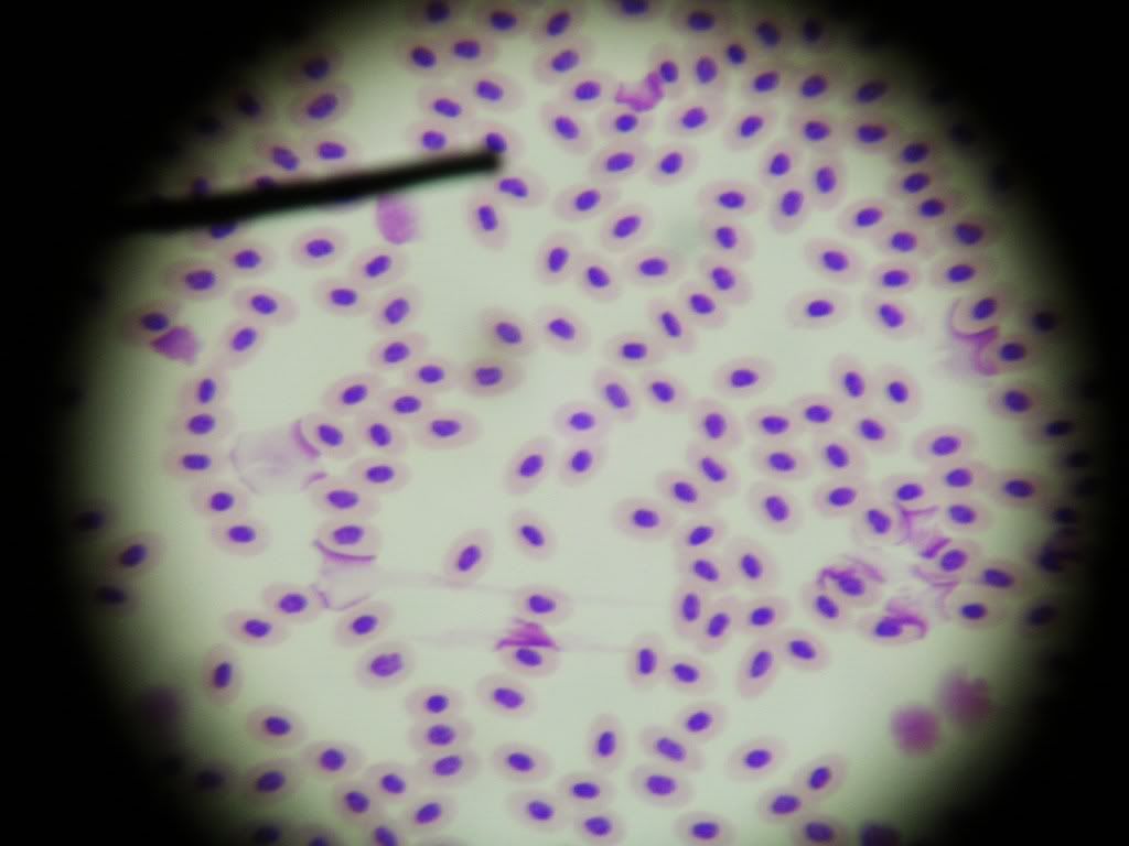 Bird Blood Smear Photo by jdoncost Photobucket